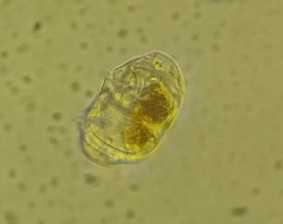 Plancton Andino: Expertos analizan impacto de la microalga Cochlodinium spp