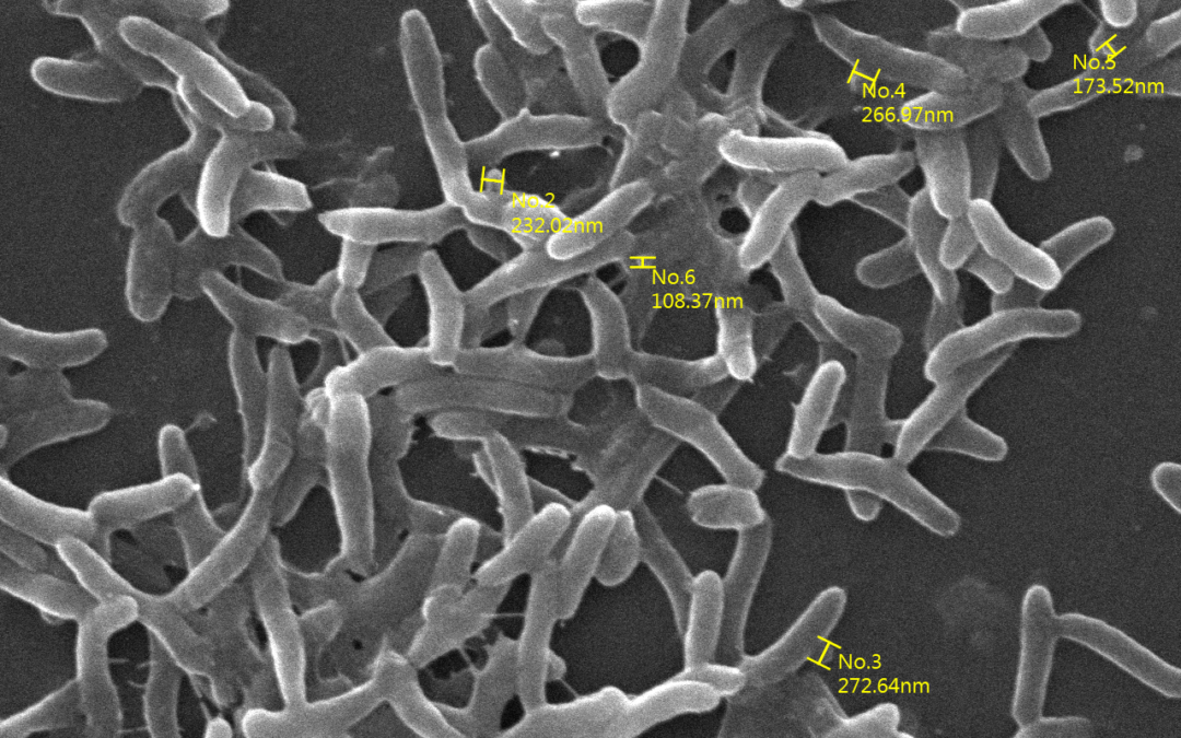 Salmonicultura: Caracterizan vesículas de la membrana externa de Vibrio ordalii