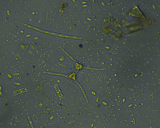 Plancton Andino es acreditada para análisis de fitoplancton y microalgas de aguas continentales